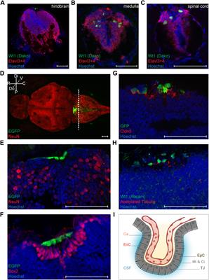 The Wilms Tumor Gene wt1a Contributes to Blood-Cerebrospinal Fluid Barrier Function in Zebrafish